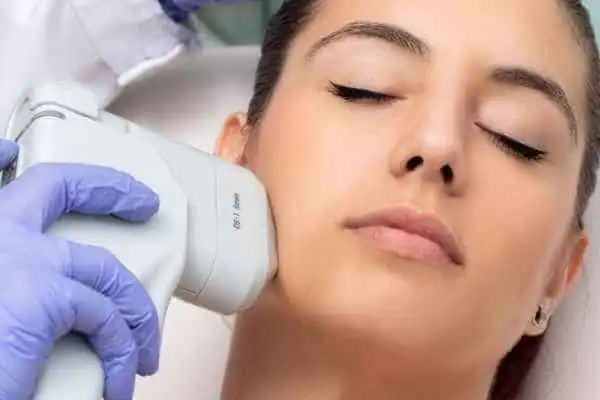 Image of woman having HIFU Bradford treatment