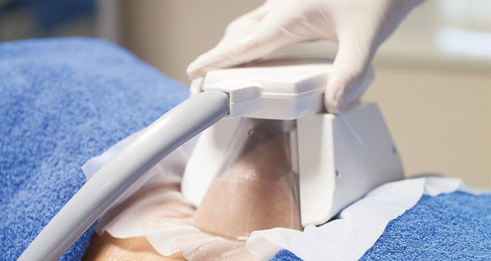 Multiple Areas in One Session HIFU and Fat Freezing Bradford