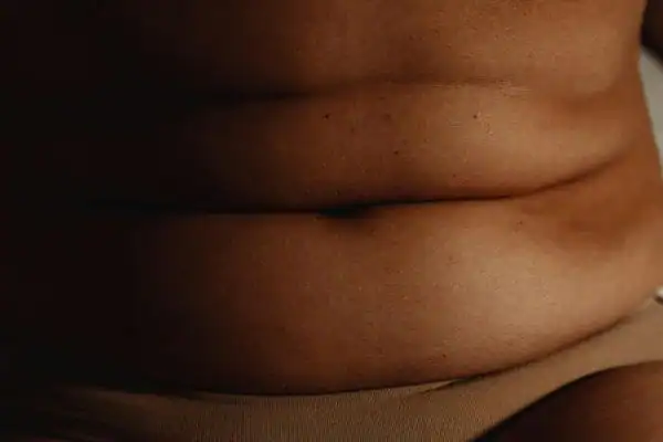 The Hidden Connection: How Stress Shapes Your Fitness and Body Composition 3 image of what stress can do on the stomach area and how Lipo 360 Bradford can help to change your body shape.