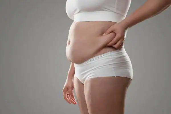 Image of stress belly Bradford How Lipo 360 can help manage your symptoms